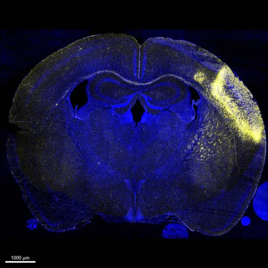 Das Bild zeigt einen Querschnitt durch ein Gehirn einer Maus. Es ist mit fluoreszierenden Farbstoffen gefärbt, die unterschiedliche Strukturen hervorheben.