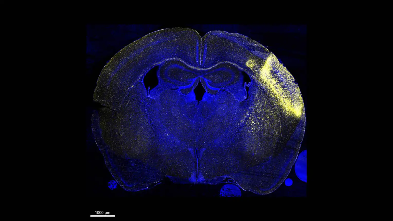 Das Bild zeigt einen Querschnitt durch ein Gehirn einer Maus. Es ist mit fluoreszierenden Farbstoffen gefärbt, die unterschiedliche Strukturen hervorheben.